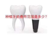 种牙多少钱一颗,价格构成与影响因素全面解析
