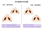 鼻综合多少钱,价格构成与影响因素全面解析