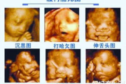 彩超多少钱,全面解析价格构成与影响因素