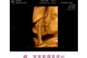 妇科彩超多少钱,价格因素与省钱指南-全面解析