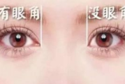 开眼角要多少钱：全面解析眼部整形手术费用构成与影响因素