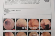 胃镜多少钱,全面解析费用构成与影响因素