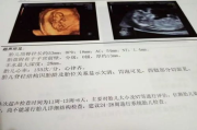 NT检查费用全解析：产前筛查的成本与价值