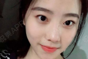 去眼袋手术多少钱啊-价格构成与影响因素全面解析