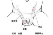 隐睾手术费用全面解析,影响因素与医保报销指南
