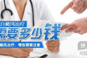 治疗白癜风要多少钱-全面费用分析与经济治疗方案