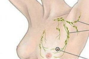 腋下副乳手术多少钱,费用构成与影响因素全面解析