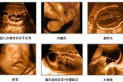 四维多少钱,全面解析四维检查价格与性价比选择
