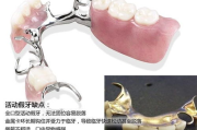补牙要多少钱：全面解析补牙费用构成与影响因素